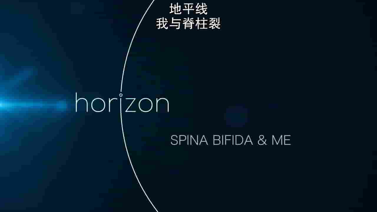  BBC纪录片/地平线系列《我与脊柱裂 Spina Bifida and Me 2018》全1集 英语内嵌中英双字 720P高清网盘