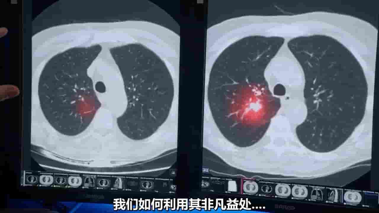 PBS纪录片《人工智能革命 A.I. Revolution 2024》全1集 英语中字 720P高清网盘