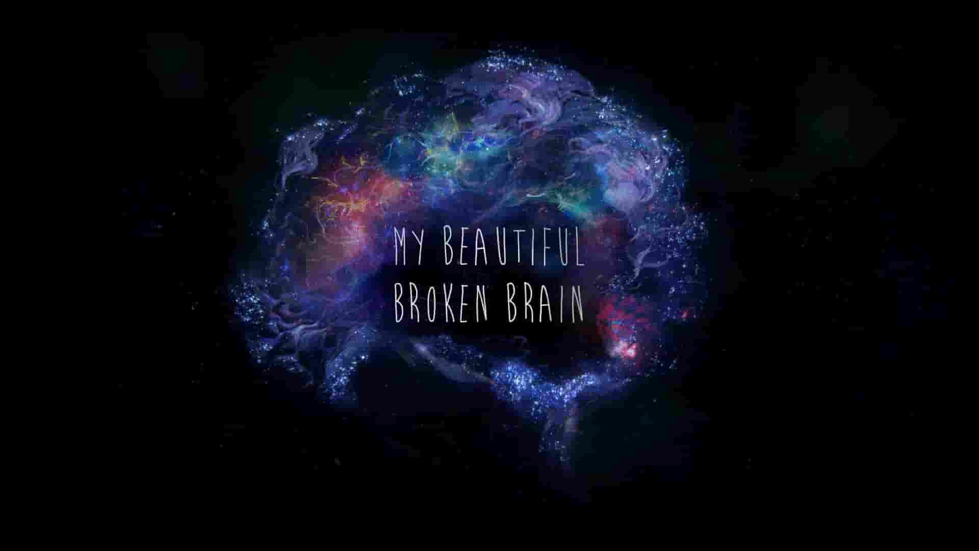 Netflix纪录片《脑残新世界：我美丽易碎的大脑 My Beautiful Broken Brain 2014》全1集 英日双语多国字幕 1080P高清网盘